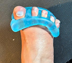 Toe separator